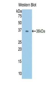 Polyclonal Antibody to E-cadherin