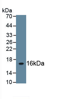 Polyclonal Antibody to Fibronectin (FN)