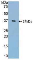 Polyclonal Antibody to Fibronectin (FN)