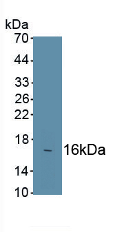 Polyclonal Antibody to Fibronectin (FN)