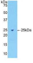 Polyclonal Antibody to Fibronectin (FN)