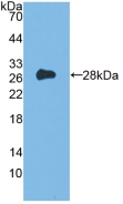 Polyclonal Antibody to FMS Like Tyrosine Kinase 3 (Flt3)