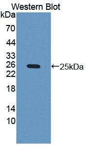 Polyclonal Antibody to Colony Stimulating Factor 3, Granulocyte (GCSF)