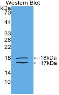 Polyclonal Antibody to Inhibin Beta E (INHbE)