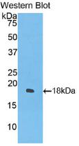 Polyclonal Antibody to Interferon Gamma (IFNg)