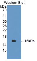 Polyclonal Antibody to Interferon Gamma (IFNg)