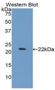 Polyclonal Antibody to Insulin Like Growth Factor Binding Protein 1 (IGFBP1)