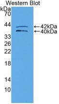 Polyclonal Antibody to Insulin Like Growth Factor Binding Protein 1 (IGFBP1)