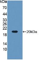 Polyclonal Antibody to Insulin Like Growth Factor Binding Protein 3 (IGFBP3)