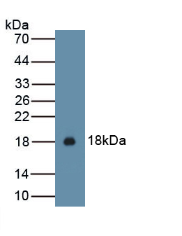 Polyclonal Antibody to Interleukin 15 (IL15)