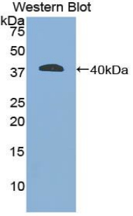 Polyclonal Antibody to Glial Fibrillary Acidic Protein (GFAP)