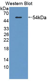 Polyclonal Antibody to Glial Fibrillary Acidic Protein (GFAP)