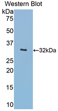 Polyclonal Antibody to Meningioma Expressed Antigen 5 (MGEA5)