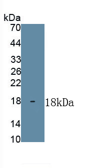 Polyclonal Antibody to Interleukin 2 (IL2)