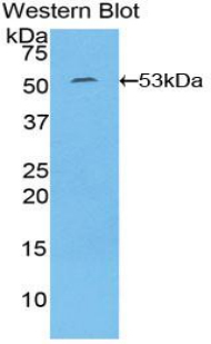 Polyclonal Antibody to Interleukin 6 (IL6)