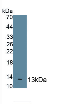 Polyclonal Antibody to Interleukin 8 (IL8)