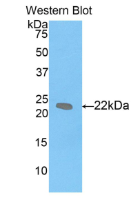 Polyclonal Antibody to Leukemia Inhibitory Factor (LIF)