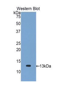 Polyclonal Antibody to Monocyte Chemotactic Protein 1 (MCP1)