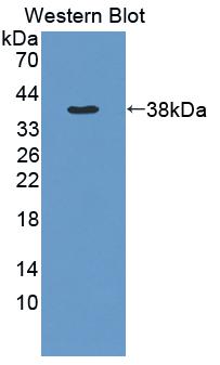 Polyclonal Antibody to Matrix Metalloproteinase 1 (MMP1)