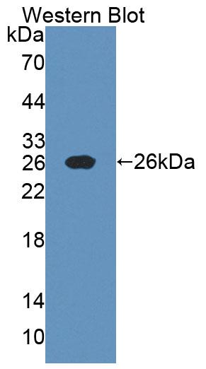 Polyclonal Antibody to Nerve Growth Factor (NGF)