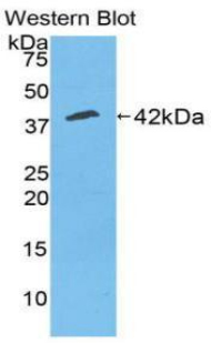 Polyclonal Antibody to Creatine Kinase, Muscle (CKM)