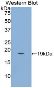 Polyclonal Antibody to Placenta Growth Factor (PLGF)