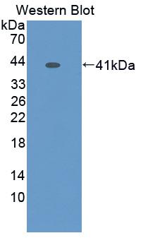 PAA115Hu01.jpg