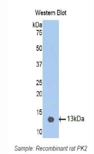 PAA115Ra01.jpg