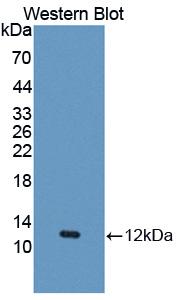 Polyclonal Antibody to Regulated On Activation In Normal T-Cell Expressed And Secreted (RANTES)