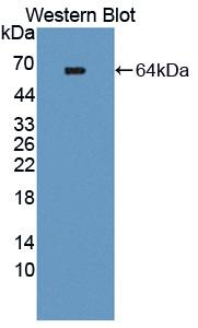 Polyclonal Antibody to TEK Tyrosine Kinase, Endothelial (Tie2)