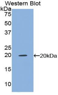 Polyclonal Antibody to Tumor Necrosis Factor Alpha (TNFa)