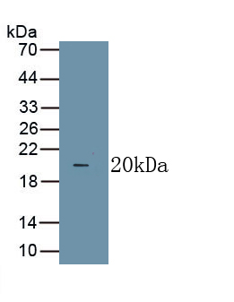 Polyclonal Antibody to Tumor Necrosis Factor Alpha (TNFa)