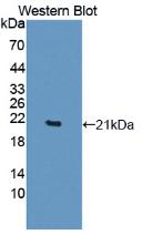 Polyclonal Antibody to Tumor Necrosis Factor Alpha (TNFa)