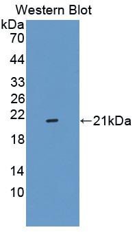 Polyclonal Antibody to Tumor Necrosis Factor Alpha (TNFa)