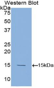 Polyclonal Antibody to Tumor Necrosis Factor Beta (TNFb)