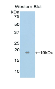 Polyclonal Antibody to Tumor Necrosis Factor Beta (TNFb)