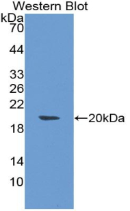 Polyclonal Antibody to Tumor Necrosis Factor Beta (TNFb)