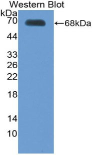 Polyclonal Antibody to Thrombopoietin (TPO)