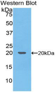 PAA139Hu01.jpg