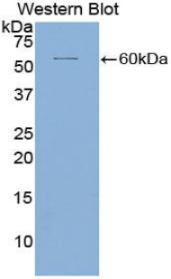 PAA142Hu01.jpg