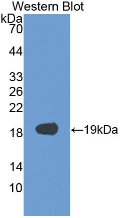 Polyclonal Antibody to Vascular Endothelial Growth Factor A (VEGFA)