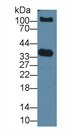 PAA151Hu01.jpg