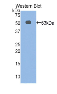 Polyclonal Antibody to Alpha-Fetoprotein (AFP)