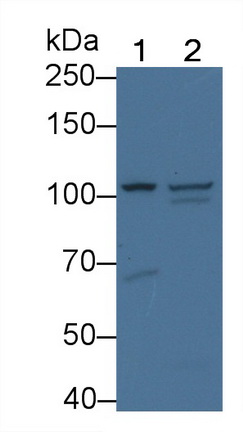 Polyclonal Antibody to Glucosidase Alpha, Acid (GaA)