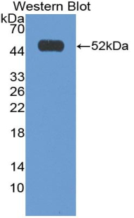 PAA179Hu02.jpg