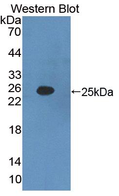 Polyclonal Antibody to Interferon Alpha 2 (IFNa2)