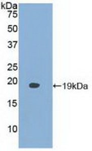 Polyclonal Antibody to Fatty Acid Binding Protein 9, Testis (FABP9)