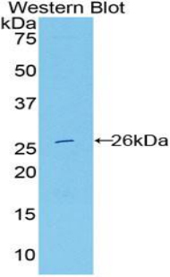 Polyclonal Antibody to Deoxyribonuclease I Like Protein 2 (DNASE1L2)