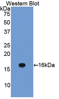 Polyclonal Antibody to Caveolin 1 (CAV1)