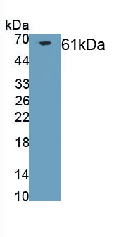 Polyclonal Antibody to Collagen Type I Alpha 2 (COL1a2)